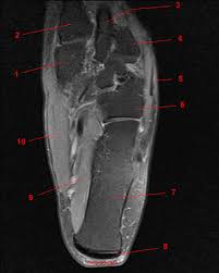 They are individual positioned medial to their respective tendon of the flexor digitorum longus. Mri Of The Ankle Detailed Anatomy W Radiology