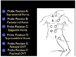 In altre parole, rappresenta un protocollo ecografico indirizzato alla diagnosi delle. Ultrasound In Shock And Hypotension Wikem