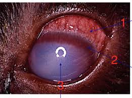 Image result for Ciliary Flush
