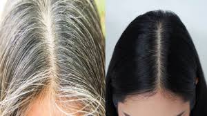 Indian home remedies for hair growth. Homemade Hair Oil Perfect Home Remedies To Make White Hair Black From The Root Make This Oil At Home Daily India