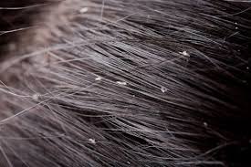 We did not find results for: Bube In Cap Tratament Naturist Lumea Fericirii