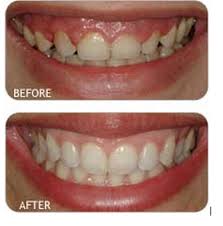 Pin On Strongsville Dental