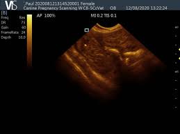 Image result for Retained Placenta