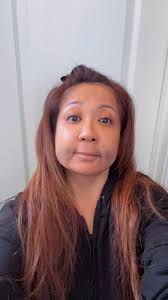 Just got home after a 3 day procedure at Bionic Smile! I'm all bruised up  and my top lip is super swollen. It still looks funny when I smile but I'll  take