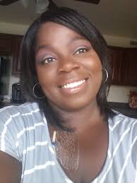 I am not shameful for my scar I am thankful for it. It's my sign of life.  The little round scar is where my dialysis peritoneal tube was and the long  scar