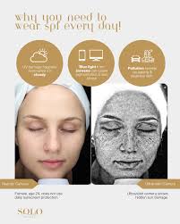 Solo Beauty Workington