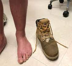 Maybe you would like to learn more about one of these? What Is This Construction Worker S Spreading Itchy Rash Consultant360