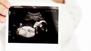 Una Bebe Nace Con Una Frondosa Cabellera Que Ya Era Visible A Las 34 Semanas De Embarazo Fotos Video Rt