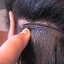 Atasha graham, 34, who had used hair extensions for 14. Woman Dies From Allergic Reaction To Weave Glue