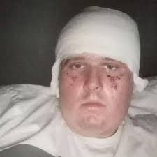 Man's life saved by new tracksuit as explosion leaves him in coma