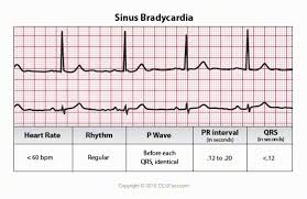 Ecg Interpretation Ecg Interpretation Ekg Medical Surgical Nursing
