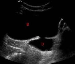 Genitourinary Radiology
