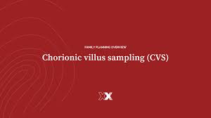 Image result for Chorionic Villus Sampling