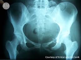 First we will show a bunch of fun radiographs of the more unusual pets we see at our hospital. How To Read Pelvic X Rays International Emergency Medicine Education Project
