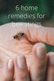 6 Home Remedies For Bee Stings Remedies For Bee Stings Bee Sting Relief Bee Sting