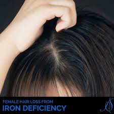Spironolactone is used to treat high blood pressure, and some women take it to stop hair loss. Pin Pa Hair Restoration With Aesthetic Scalp