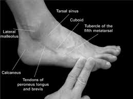 Malleolus in a sentence and translation of malleolus in english dictionary with audio pronunciation coupled with the torn cartilage on the talus and medial malleolus, it means she was hung upside. Lateral Malleolus An Overview Sciencedirect Topics