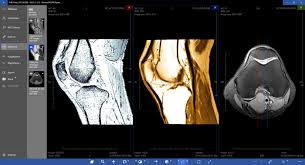 Aliza ms dicom viewer 1.4.2. Dicom Viewer Expert By Medical Harbour Windows Apps Appagg