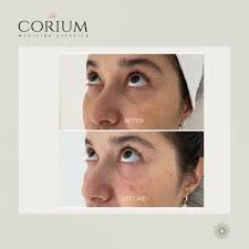 coriummedicinaestetica