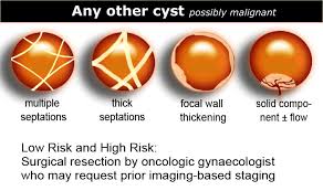 The Radiology Assistant Ovarian Cysts Diagnostic Work