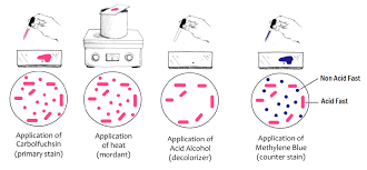 ziehl neelsen stain zn stain principle procedure