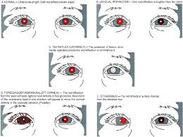 There is free parking in front of and behind the kittner eye center. Pediatric Eye Evaluations Preferred Practice Pattern Ophthalmology
