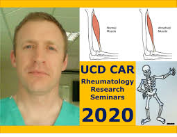 UCD Rheumatology