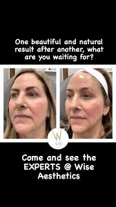 Don’t you just love before an after photos? , We love them at Wise  Aesthetics We have nothing to hide, but great results., Did you know that  our patients have no make up