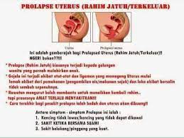 Jepang, istri sakit ku datangi kamar anak tiri. Facebook