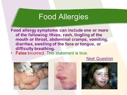 Learn about the most common culprits and how to manage these conditions. Create A Healthy Lifestyle Have An Allergy Click Here Ppt Download
