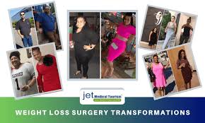 Choosing A Bariatric Surgeon In Tijuana A Step By Step Guide