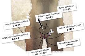 Schöne Schamlippen, straffe Hodensäcke — kreuzer online