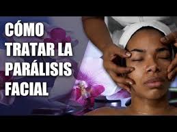 Ejercicios para paralisis facial
