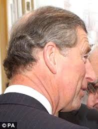 Bad news for baldies: Losing your hair before your 50s can almost DOUBLE  the risk of heart attack