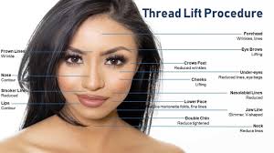 Thread lift before and after eyes. Thread Lift Threadlift Skincredible Dermatology Surgery