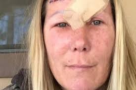 Fundraiser for Nicole Ballum by Kristy Passmore : Nicole Ballum's out of  pocket medical expenses