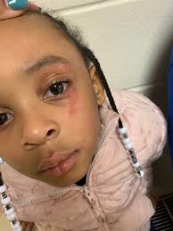 Shelby County Schools teacher hit 5-year-old with a ruler, mother says