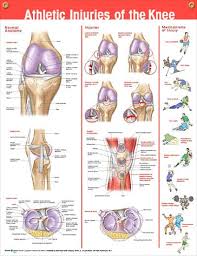 Athletic Injuries Of The Knee Chart 20x26 Healthy _