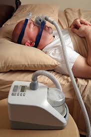 Image result for Sleep Apnea