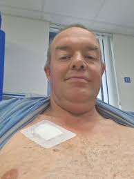 Catheter removal after 5 months of dialysis