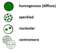 Antinuclear Antibody Ana Understand The Test