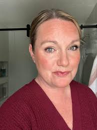 Color correctors for acne, rosacea, and more