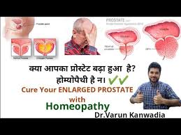ह म य प थ स बढ ह ए प र स ट ट स प ए न ज त 5 Best Homeopathy Medicines For Prostate Enlargement Youtube