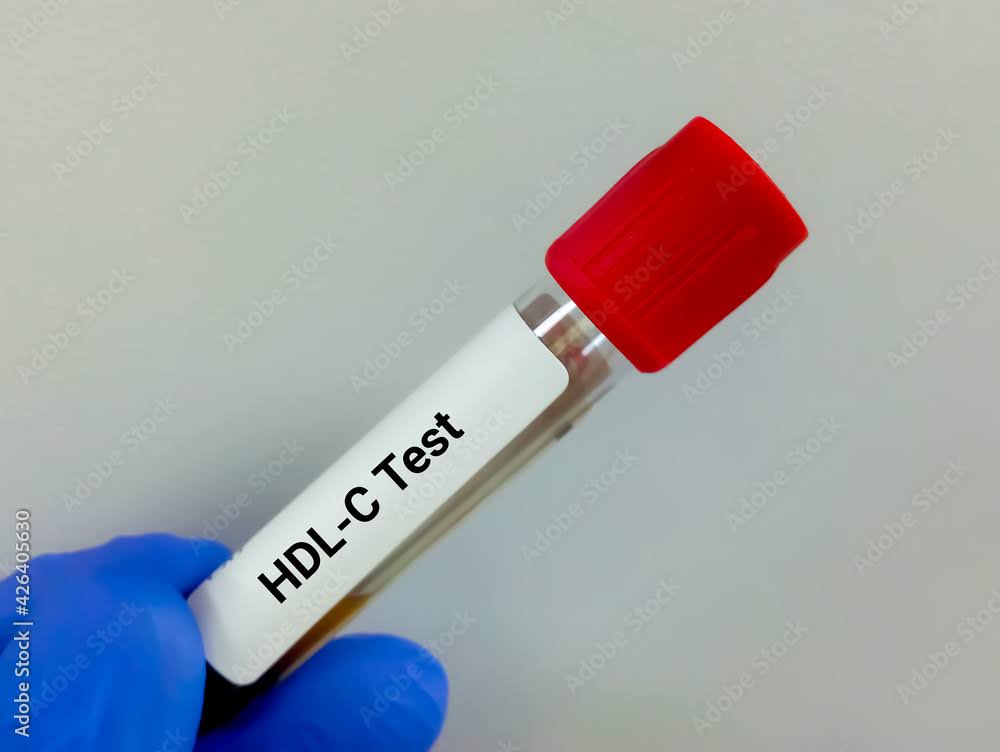 HDL product image