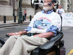 Als stands for amyotrophic lateral sclerosis. Amyotrophic Lateral Sclerosis Als Causes Symptoms And Treatment
