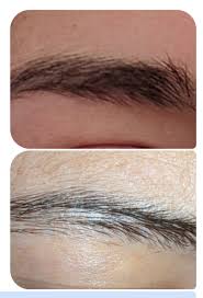 The case is the same with zinc levels. Why Are My Eyebrows Thinning Eyebrows
