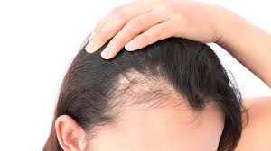 Looking for the best hair growth products for black hair? A Wearable Device For Regrowing Hair Tech Explorist