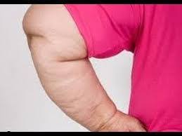 السليوليت انواعه واسبابه وافضل طرق لعلاجه صيدليات نور الدين Nour Eldeen Pharmacies فيسبوك
