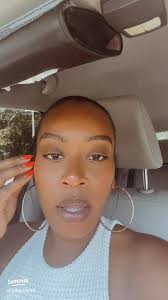 Exciting Braces-Off Day: My Journey Ends! 😬