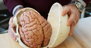It is located in the head. These St Louis Scientists Are Shaking Human Brains To Study Head Trauma St Louis Public Radio